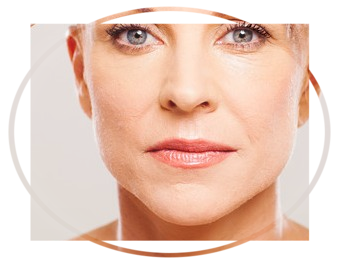 Fillers